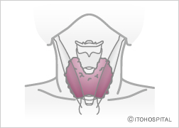 びまん性甲状腺腫